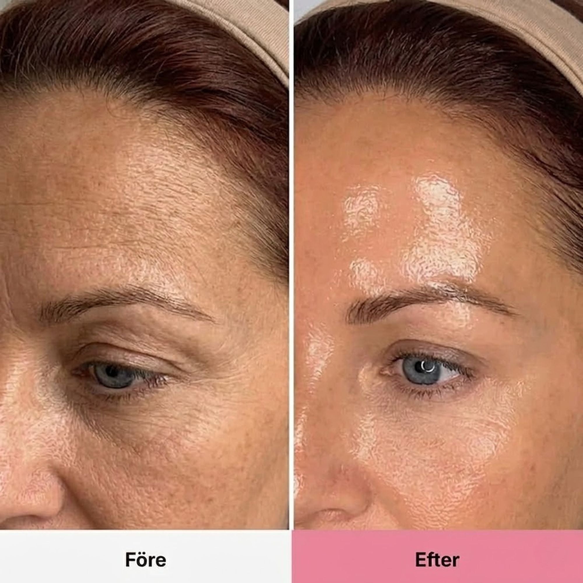 Nordic Glow's PDRN Collagen Balm
